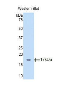 Polyclonal Antibody to T-Box Protein 3 (TBX3)