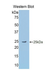 Polyclonal Antibody to Gastrokine 2 (GKN2)