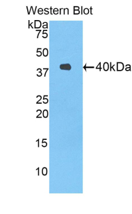 Polyclonal Antibody to Delta Like Protein 4 (dLL4)