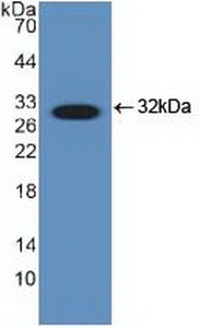 Polyclonal Antibody to DNA Damage Inducible Transcript 3 (DDIT3)