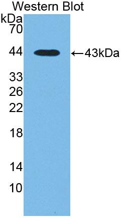 Polyclonal Antibody to Di-N-Acetyl Chitobiase (CTBS)