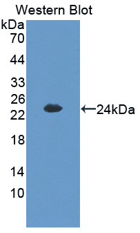 Polyclonal Antibody to Cbp/p300 Interacting Transactivator, With Glu/Asp Rich Carboxy Terminal Domain 1 (CITED1)
