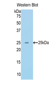 Polyclonal Antibody to DNA Repair Protein RAD50 (RAD50)