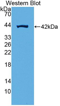 Polyclonal Antibody to Succinate Dehydrogenase Complex Subunit C (SDHC)