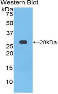Polyclonal Antibody to Patched Homolog 1 (PTCH1)