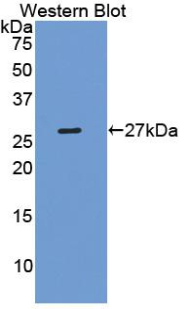 Polyclonal Antibody to Pentraxin 3, Long (PTX3)