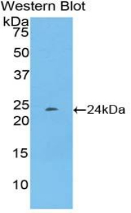 Polyclonal Antibody to Pentraxin 3, Long (PTX3)