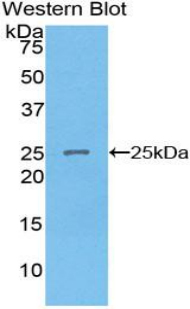Polyclonal Antibody to Sprouty Homolog 2 (SPRY2)