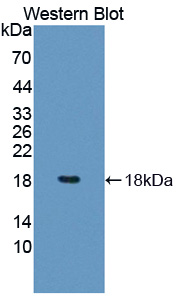 Polyclonal Antibody to Programmed Cell Death Protein 5 (PDCD5)