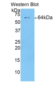 Polyclonal Antibody to CD5 Antigen Like Protein (CD5L)