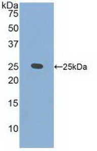 Polyclonal Antibody to CASP2 And RIPK1 Domain Containing Adaptor With Death Domain Protein (CRADD)