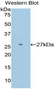 Polyclonal Antibody to DIX Domain Containing Protein 1 (DIXDC1)