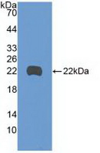 Polyclonal Antibody to Growth Arrest And DNA Damage Inducible Protein Beta (GADD45b)
