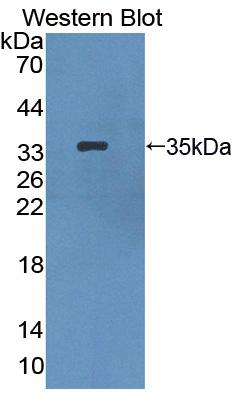 Polyclonal Antibody to Hermansky Pudlak Syndrome Protein 1 (HPS1)