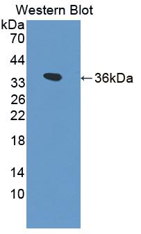 Polyclonal Antibody to Kelch Like ECH Associated Protein 1 (KEAP1)