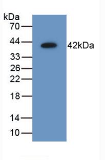 Polyclonal Antibody to Aminoacyl tRNA Synthetase Complex Interacting Multifunctional Protein 1 (AIMP1)