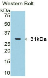 Polyclonal Antibody to PR Domain Containing Protein 1 (PRDM1)