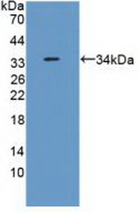Polyclonal Antibody to Ribosomal Protein S6 Kinase Alpha 1 (RPS6Ka1)