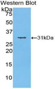 Polyclonal Antibody to Salt Inducible Kinase 2 (SIK2)