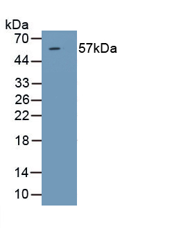 Polyclonal Antibody to Steroid 5 Alpha Reductase 1 (SRD5a1)