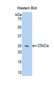Polyclonal Antibody to Zinc Finger, AN1-Type Domain Protein 6 (ZFAND6)