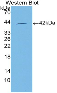 Polyclonal Antibody to Normal Mucosa Of Esophagus Specific 1 (NMES1)