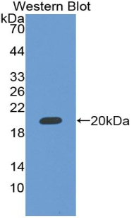 Polyclonal Antibody to RNA Binding Motif Protein 20 (RBM20)