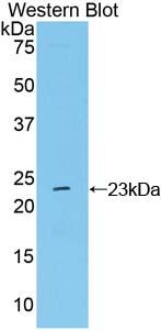 Polyclonal Antibody to Non Metastatic Cells 6, Protein Expressed In (NME6)