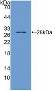 Polyclonal Antibody to Toll Interleukin 1 Receptor Domain Containing Adaptor Protein (TIRAP)