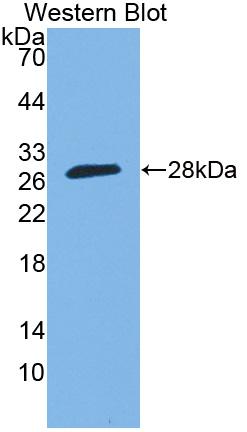 Polyclonal Antibody to Sp140 Nuclear Body Protein (SP140)