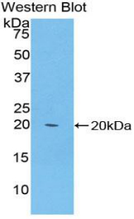 Polyclonal Antibody to Keratin 81 (KRT81)