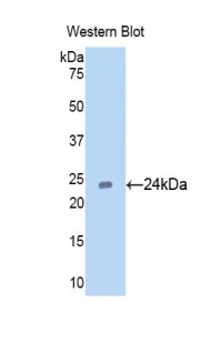 Polyclonal Antibody to Cell Division Cycle Protein 25B (CDC25B)