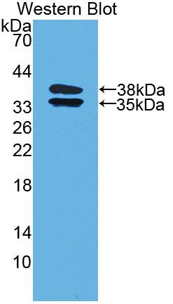 Polyclonal Antibody to C2 Calcium Dependent Domain Containing Protein 3 (C2CD3)