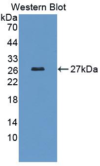 Polyclonal Antibody to ADP Ribosylation Factor Like Protein 15 (ARL15)