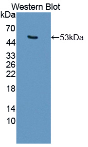 Polyclonal Antibody to Keratin 25 (KRT25)
