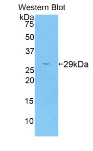 Polyclonal Antibody to A Disintegrin And Metalloprotease 6 (ADAM6)