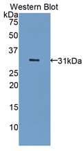 Polyclonal Antibody to Low Density Lipoprotein Receptor Related Protein 5 Like Protein (LRP5L)