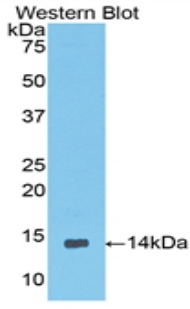 Polyclonal Antibody to Coiled Coil Domain Containing Protein 60 (CCDC60)