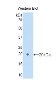 Polyclonal Antibody to Family With Sequence Similarity 132, Member A (FAM132A)