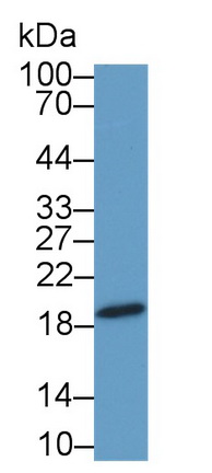 Polyclonal Antibody to Chromosome 1 Open Reading Frame 194 (C1orf194)