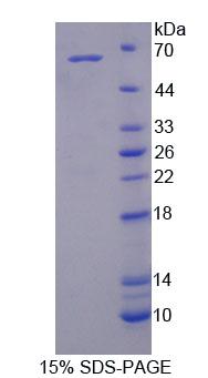 Recombinant Glycoprotein 130 (gp130)