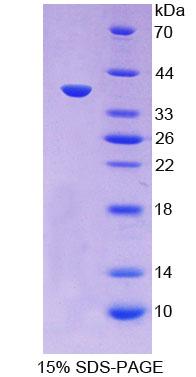 Recombinant Macrophage Inflammatory Protein 1 Alpha (MIP1a)