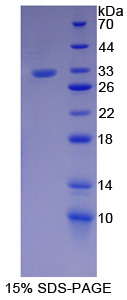 Recombinant Protein SCAF11 (SCAF11)