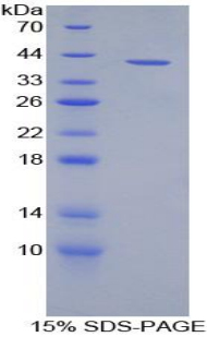 Recombinant Macrophage Inflammatory Protein 3 Alpha (MIP3a)