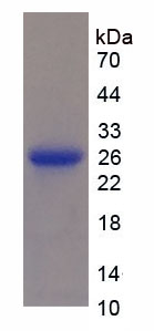 Recombinant Osteoprotegerin (OPG)