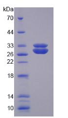 Recombinant Superoxide Dismutase 3, Extracellular (SOD3)