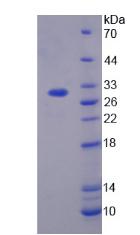 Recombinant Transforming Growth Factor Beta Induced Protein (TGFbI)