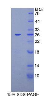 Recombinant Carbohydrate Antigen 125 (C<b>A125</b>)