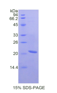 Recombinant Serpin Peptidase Inhibitor,Clade B,Member 4 (SERPINB4)