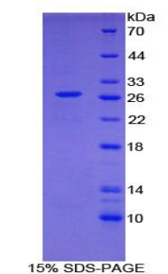 Recombinant Growth Arrest Specific Protein 2 (GAS2)